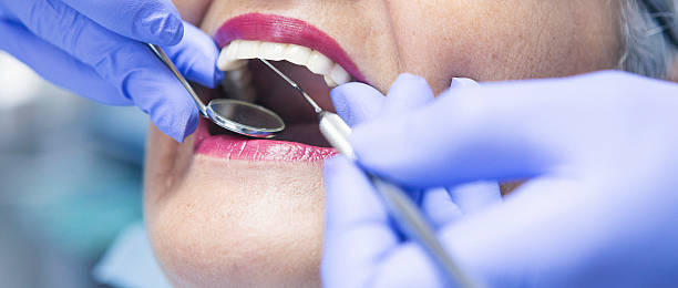 Best Emergency Broken Tooth Repair in Coral Gables, FL